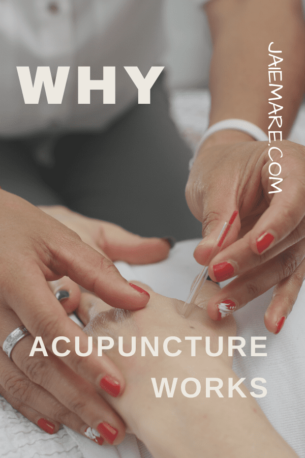 Woman receiving acupuncture 